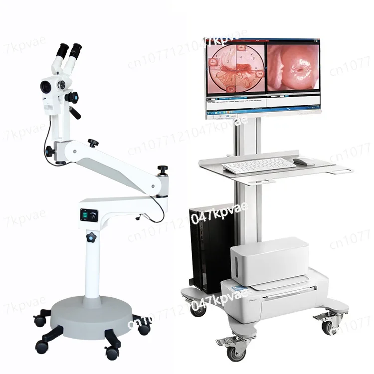 Medical Binocular Colposcope for Sale