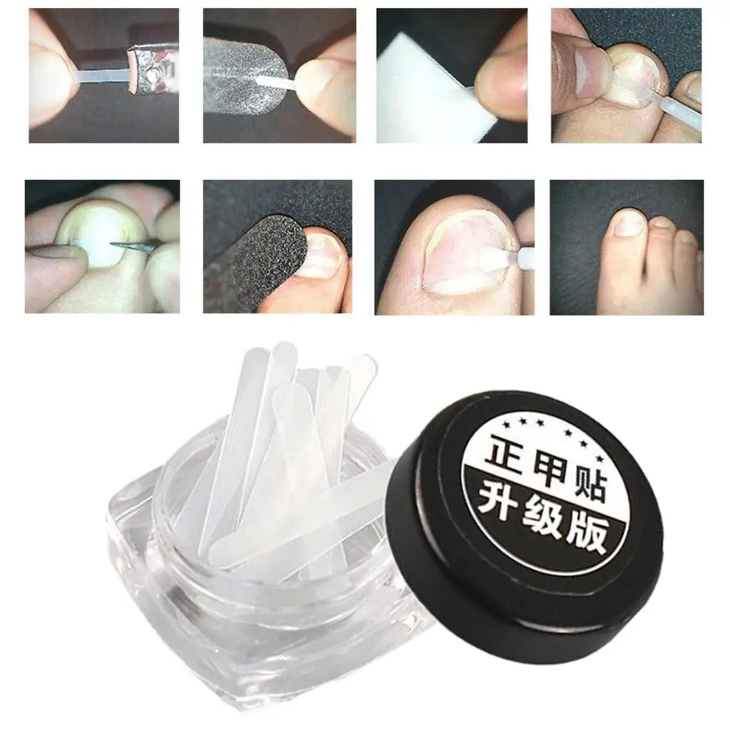 10pcs Ingrown Toenail Straightening Patch Correction Treatment Pain