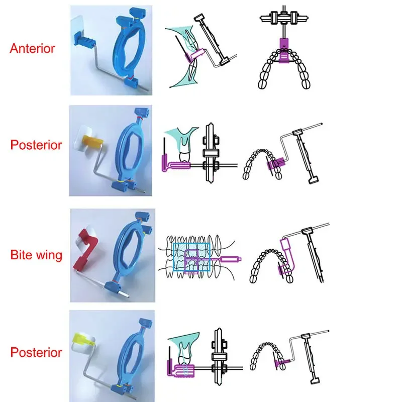 正確なフィルム位置のための歯科dddentialxrayセンサー、正確な追跡用のポジショナーキットシステム、それ以上のビットウィングの画像を撮影