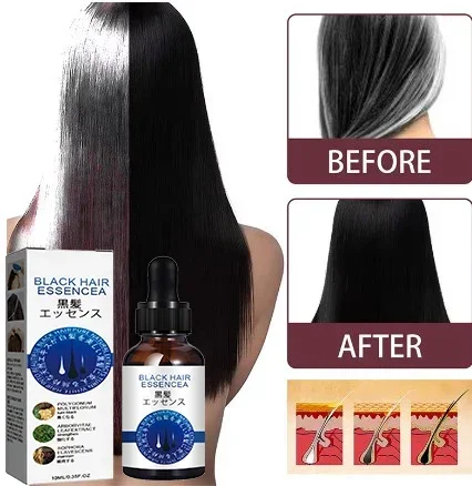 

Anti Gray Hair Essence Blackening Serum Treatment White To Black Hair Repair Care Nourish Scalp Anti Hair Loss Products NEW