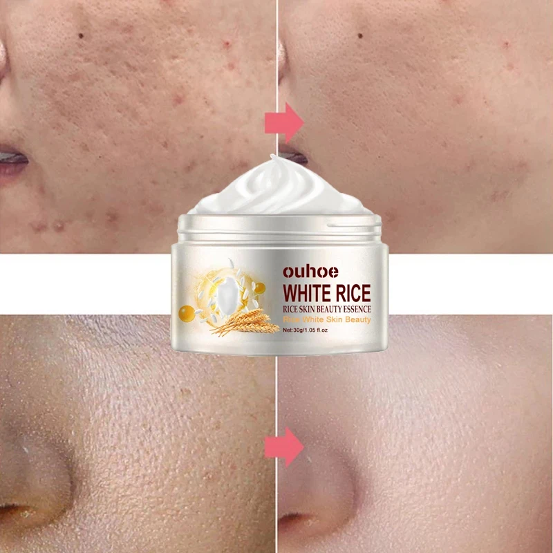 

Anti-wrinkle Facial Rice Cream Acne Melasma Treatment Pigmentation Whitening Face Lifting Beauty Moisturizer Korean Cosmetics30g