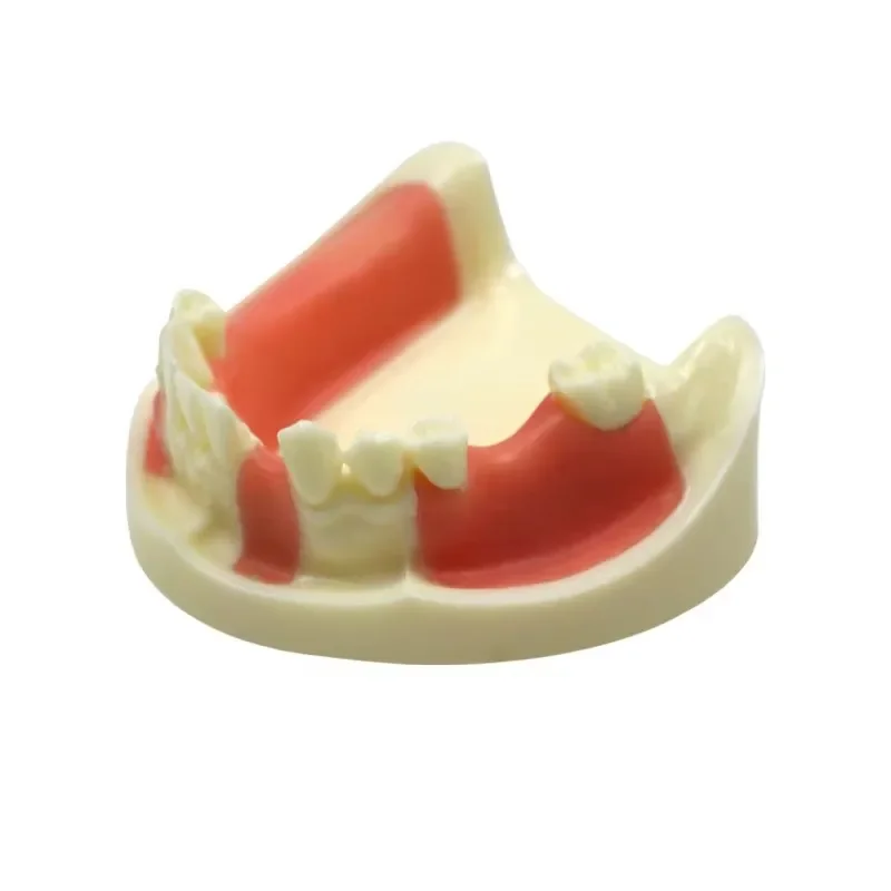 GREATLH Dental Lower Jaw Implant Practice Typodont Teeth Model with Gingiva Dentist Student Learning Model Dental Materials