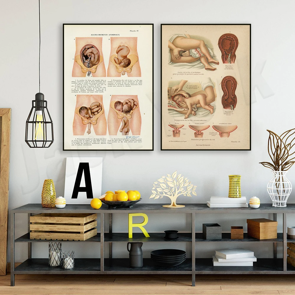 

French anatomy print, baby uterus medical gift for gynecologist, doctor poster for midwife nurse, medical student. midwife