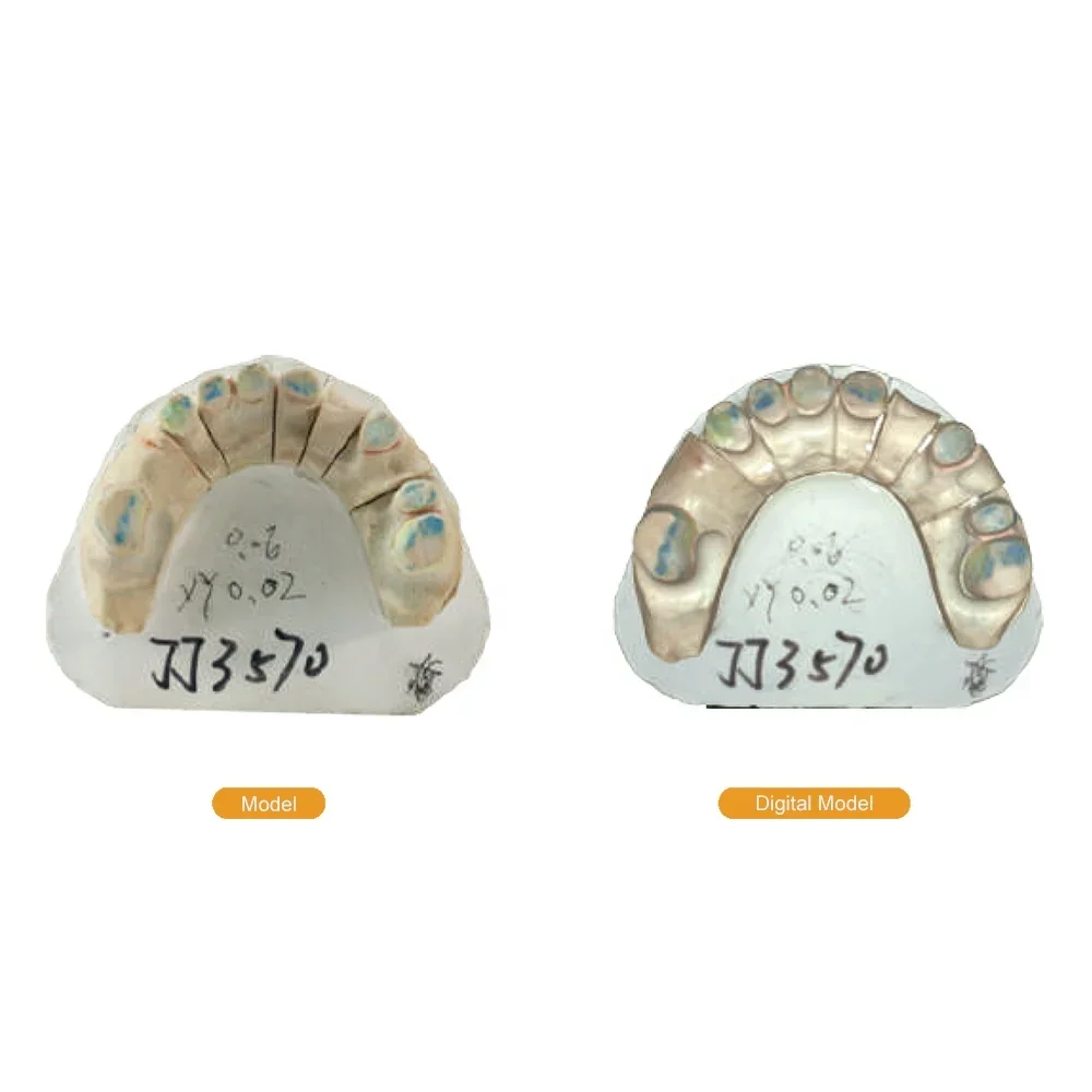 Pemindai Lab gigi sistem CAD terbuka 3D