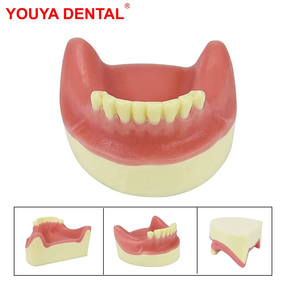 1pcs Dental Practice Model Implant Model Lower Jaw Teeth Model For Studying Training Teaching Demonstration Students Exam Models