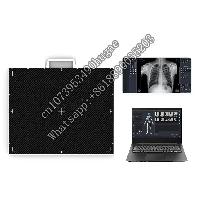 Рисунок 2 - Портативный цифровой рентгеновский