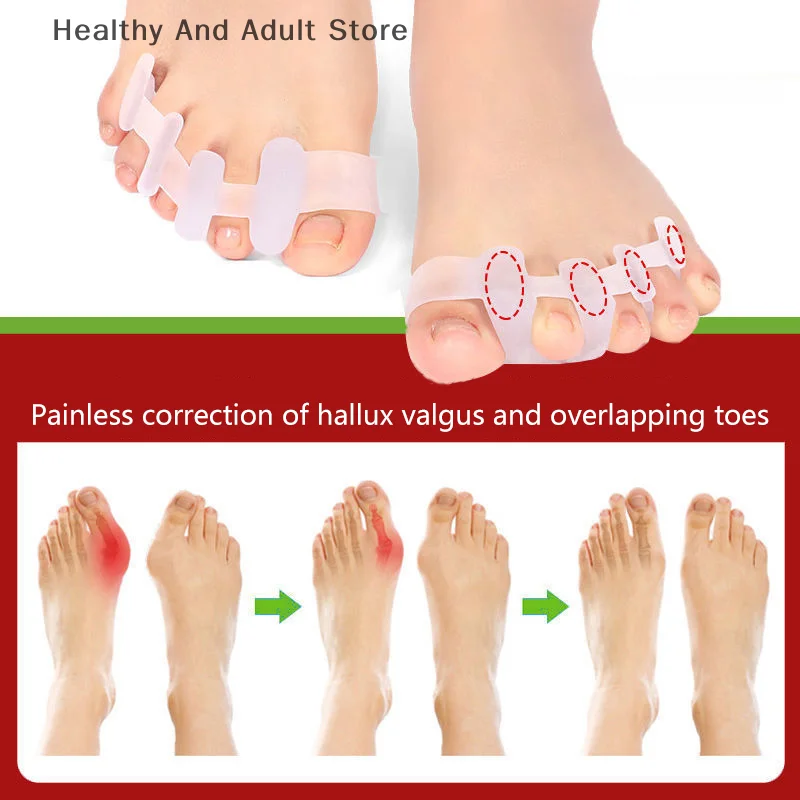 1 Paar Zehentrenner, geeignet für Bunion Corrector-Material, weiche Gel-Glätteisen-Abstandshalter