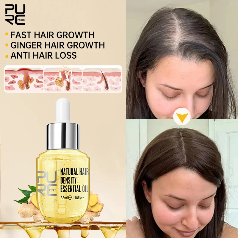 PURC Fast Hair Growth Essential Oil Ginger Ginger Hair Growth Serum for Men Women Prevent Loss Growing Scalp Treatment Products