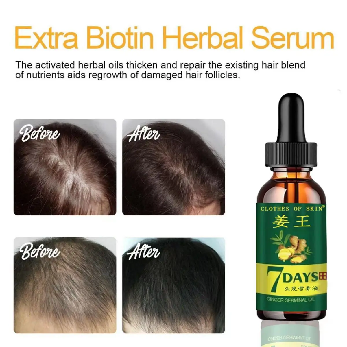 TRSTAY Hair Care Essential Oil Refreshing Nourishing Scalp Hair Follicle Nutrient Solution Strong Hair Hair Care