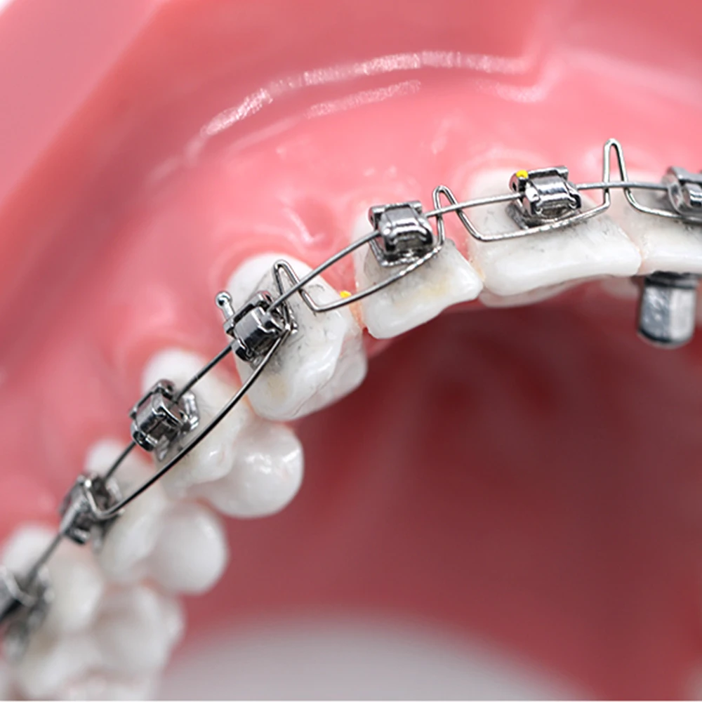 Рисунок 4 - Стоматологические аксессуары для зубных протезов