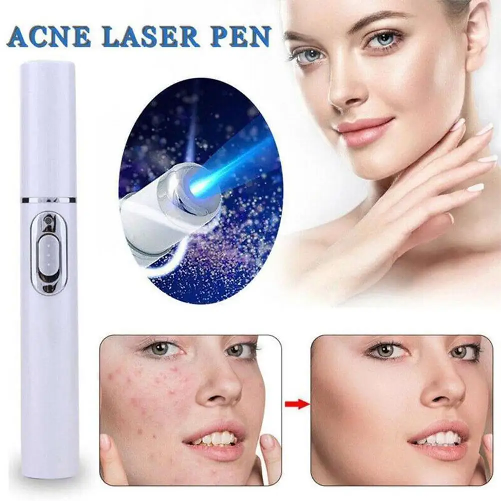 Blue Light Acne Removal Pen Eye Massager Eliminate Undereye Bags Fade Dark Circles Eye Massage Stick Face Beauty Tool Skin Care