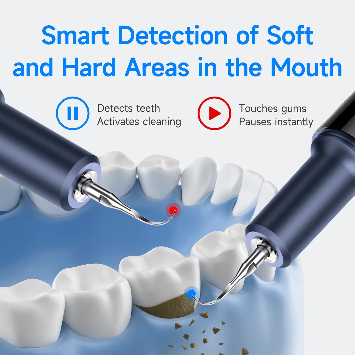 Thumbnail 4 - #31 Best Rated Ultrasonic Scalers to Buy in 2026