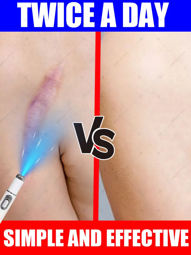 

The latest scar removal technology, best-selling product in Asia