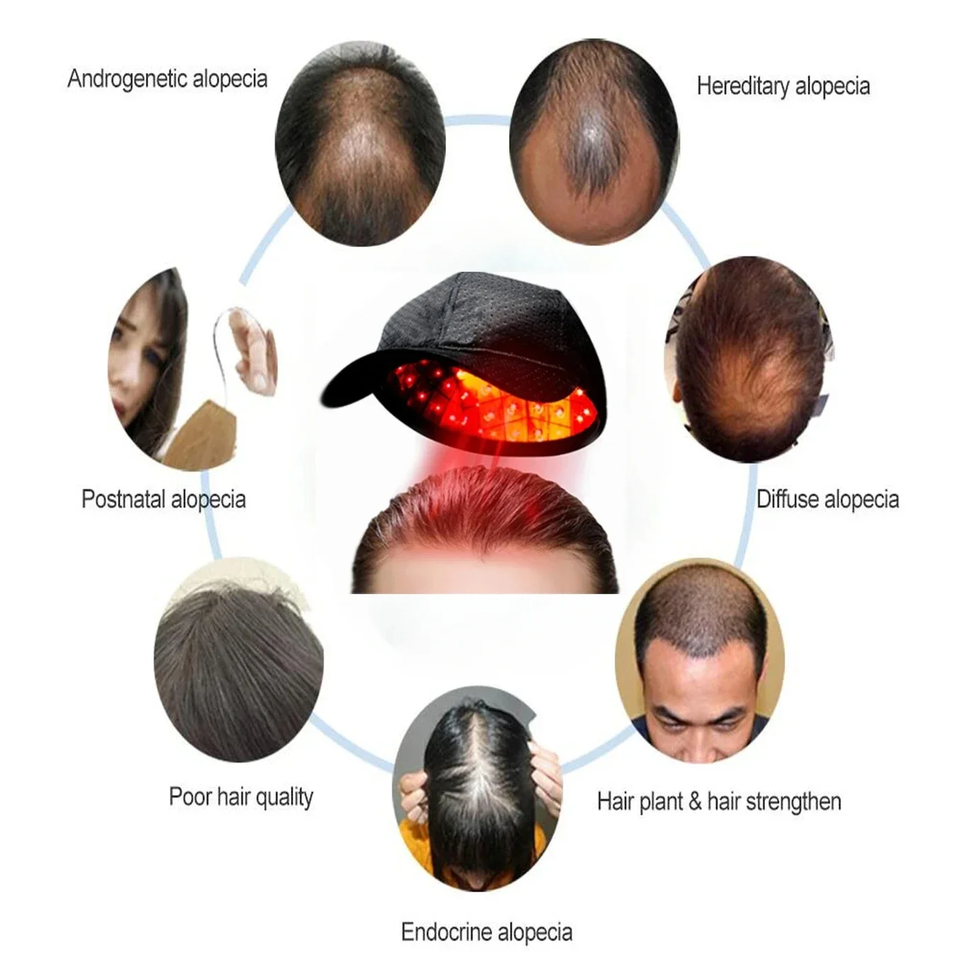 

96 Diodes Laser Hair Growth Cap LLLT Therapy Anti Hair Loss Treatment Promote Hair Regrowth Device Restore Hair Thickness