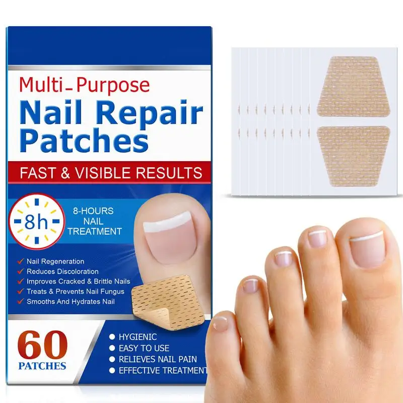 Patchs de Réparation d'Ongles Non Irritants, Autocollants pour Nail Toenail Ration Tor, Canton avec Craquelé, N64.60 Pièces/Ensemble