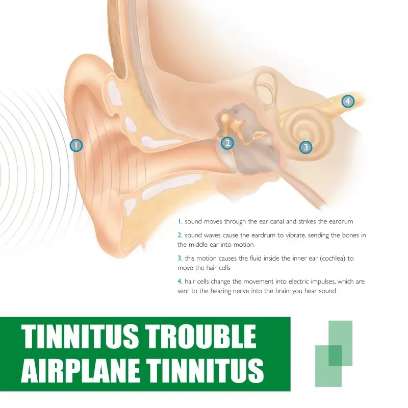 Ringing Treatment Oil Deafness Earache Relieve Ear Swelling Discharge Otitis Hearing Tinnitus Ear Drops 20ml ear cleaner