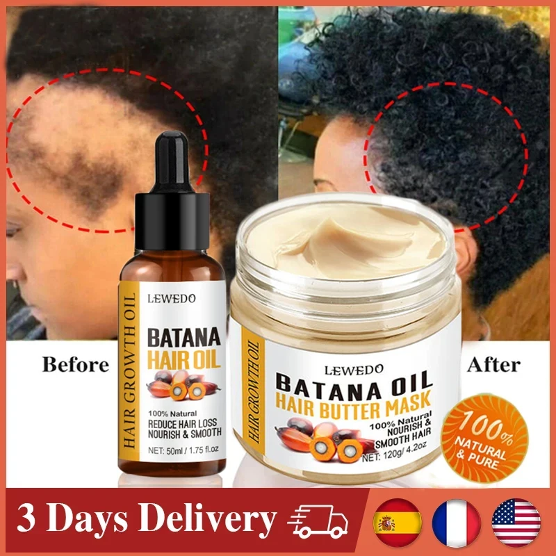 Minyak Batana Murni 100% alami untuk pertumbuhan rambut traksi minyak perawatan Alopecia pertumbuhan rambut gila alami Anti penumbuh rambut wanita