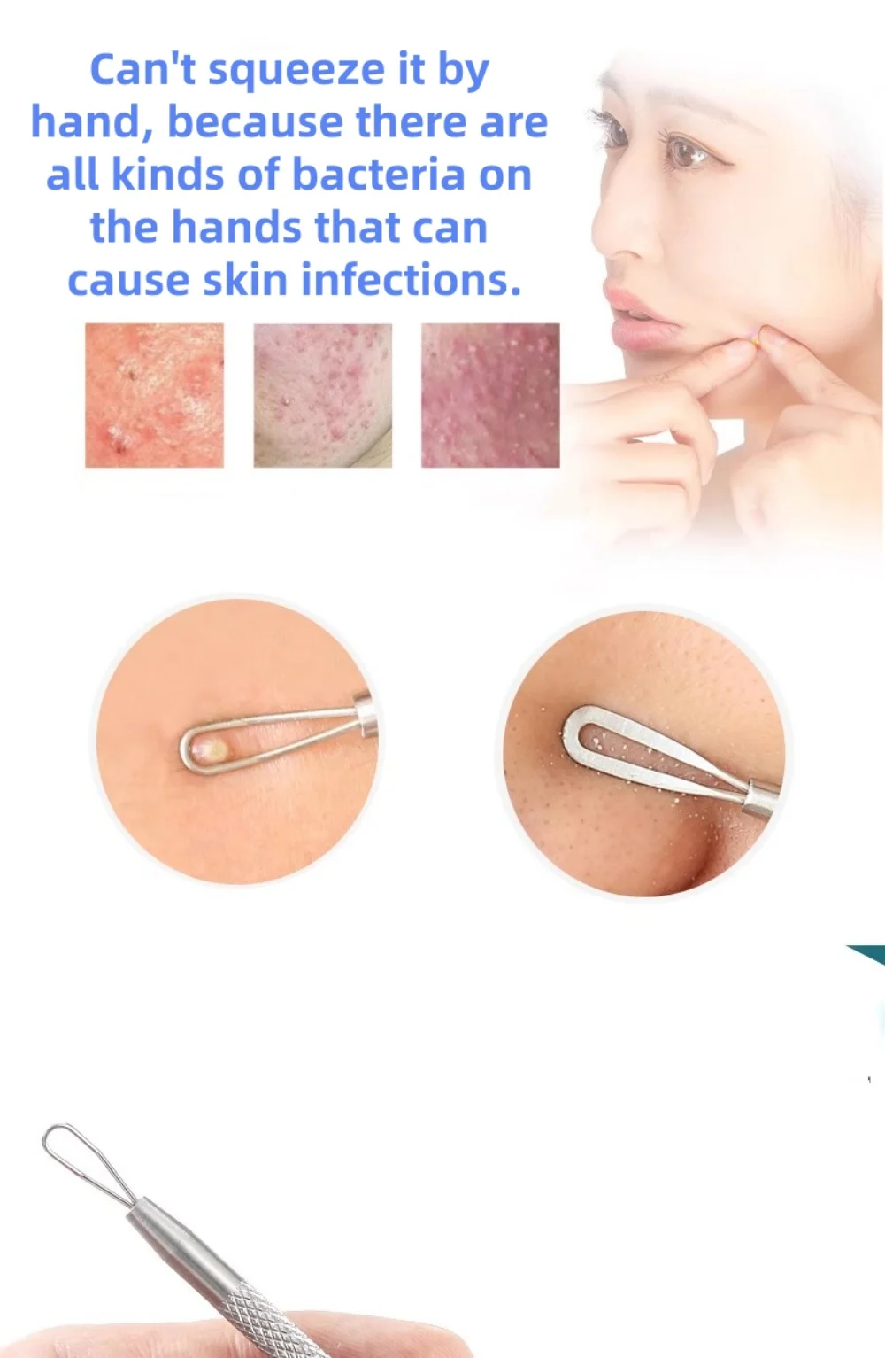 حب الشباب ضغط الرؤوس السوداء النازع. مستخرج حب الشباب مزدوج الأطراف لصالونات التجميل استخدام منظف الوجه للبشرة