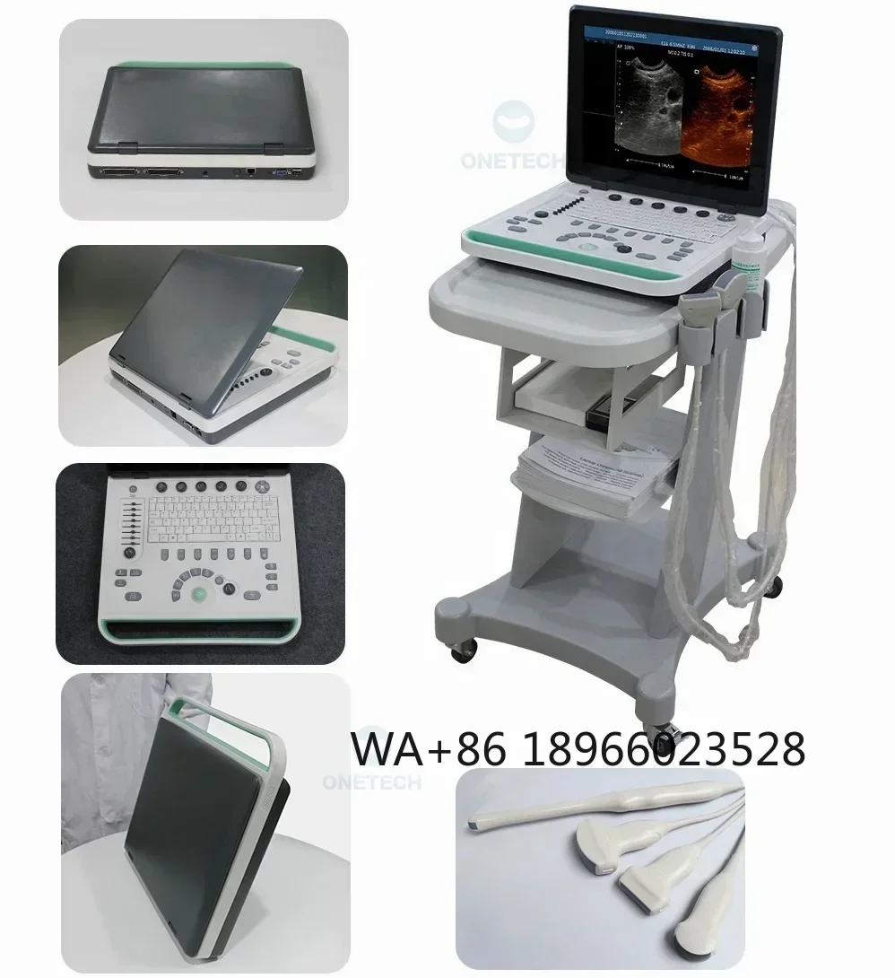 

B22VET Intelligent Animal Veterinary Ultrasound Portable /clinic Ultrasound Scanner Price for Scan