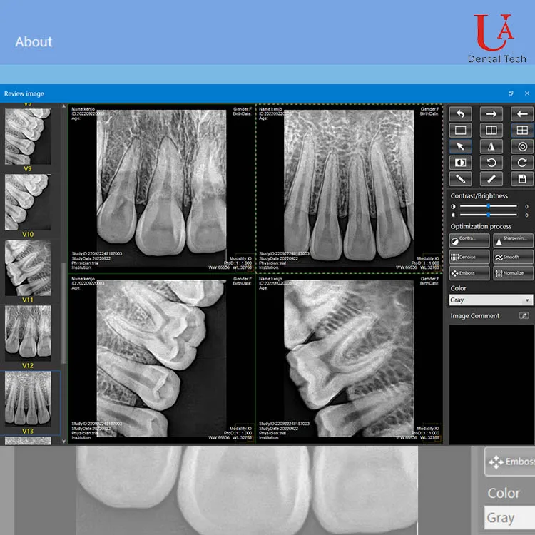Factory Direct Portable Digital RVG Photon Counting Imaging Intraoral for Child/Adult RVG Sensor