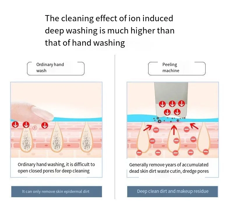 Estrattore per la pelle ad ultrasuoni per la pulizia dei pori dei punti neri del viso e la rimozione dell'acne strumento di importazione dell'essenza grassa cura della pelle