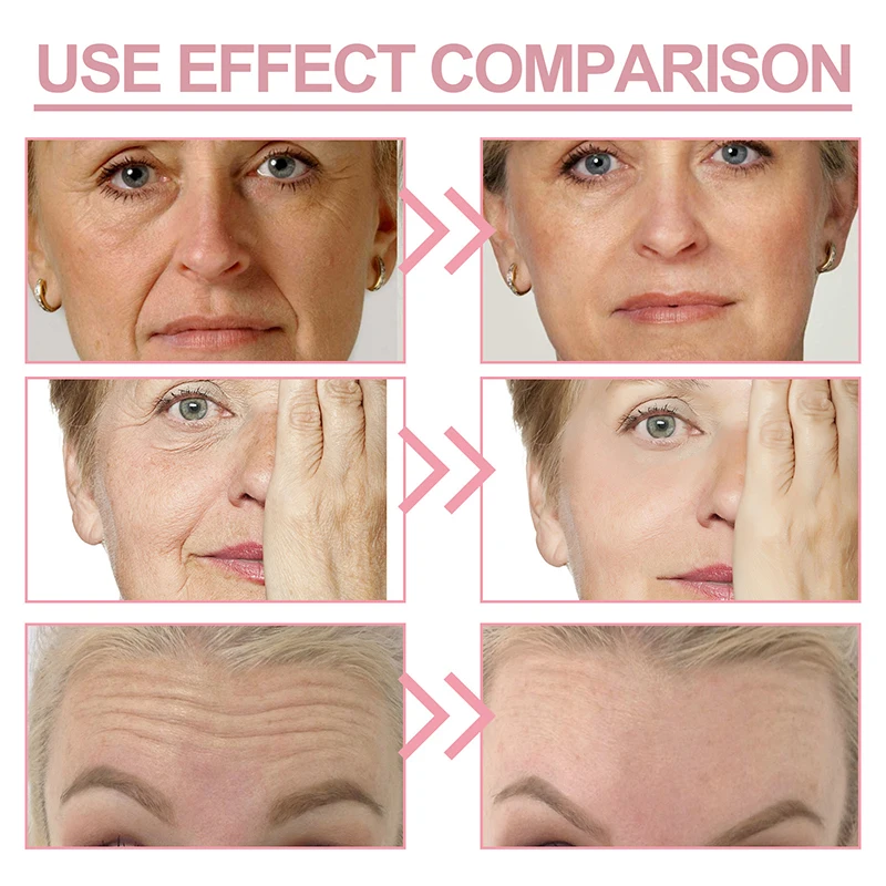 Anti-Wrinkle Eye Cream Lightening Fine Lines Moisturizing Wrinkle Removing Dark Circles Whitening Skin Care Remove Eye Bag Stick