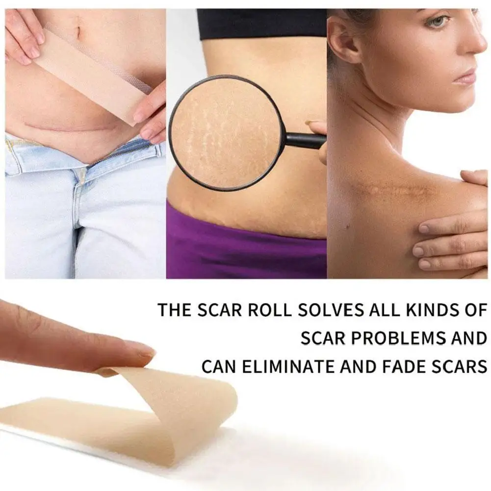 صفائح ندبة من السيليكون، حمالة ندبة من السيليكون لعلاج إزالة الندبات، شرائط ندبة من السيليكون قابلة لإعادة الاستخدام لحرق الجلويد على شكل حرف C #6