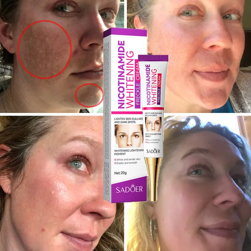 Whitening Cream Repairing Freckle Pigmentation Improving Dark Yellow Smoke Amide Reducing Melasma Facial Whitening Cream 2024