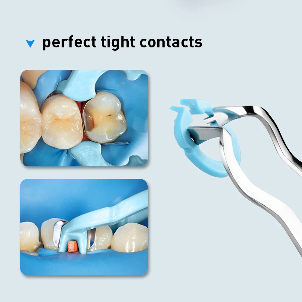 Azdent 4 pçs anel de fixação de resina dentária separador anel seccional contornos metal matriz titular matriz braçadeira fixa autoclavável