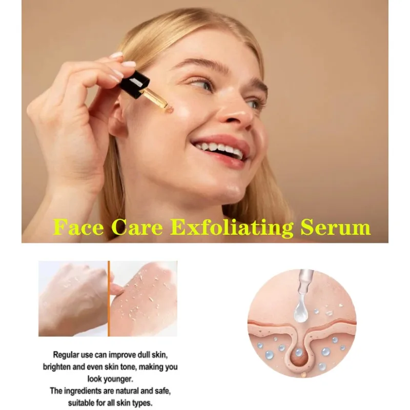 Face Care Exfoliating Serum Radiant Skin Fade Dark Spots Pigmentation for Even Brighter Skin Remove Spots Arm Knee Legs Melanin
