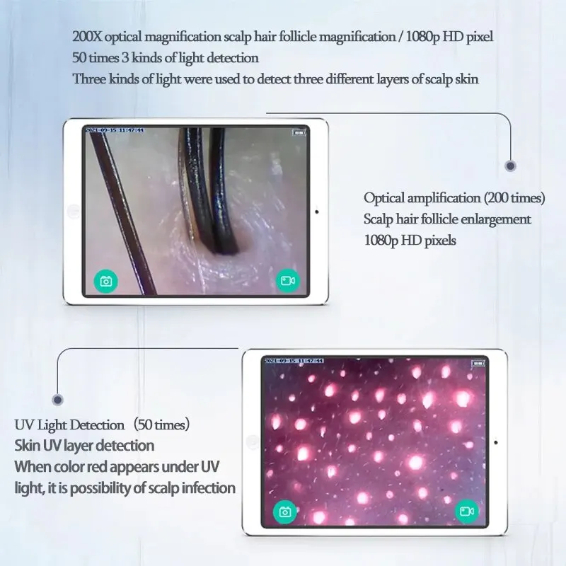 충전식 UV 테스트 분석 돋보기, 전문가용 WIFI HD 5G 두피 피부 모낭 검출기, 50X 200X 피부 분석기, 신제품