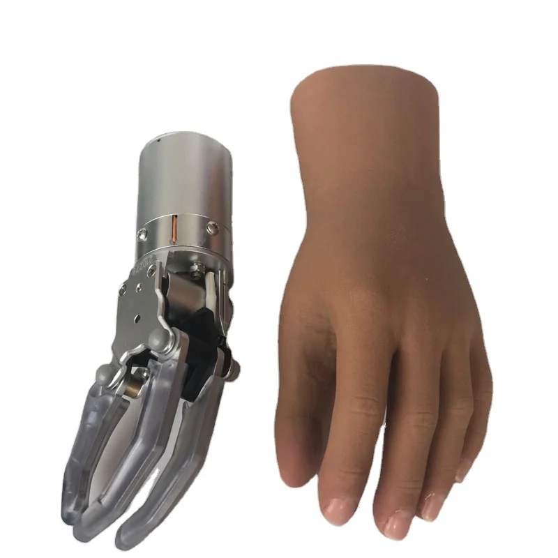 Prosthetic upper limb Myoelectric hand with two degree of freedom prosthetic foot