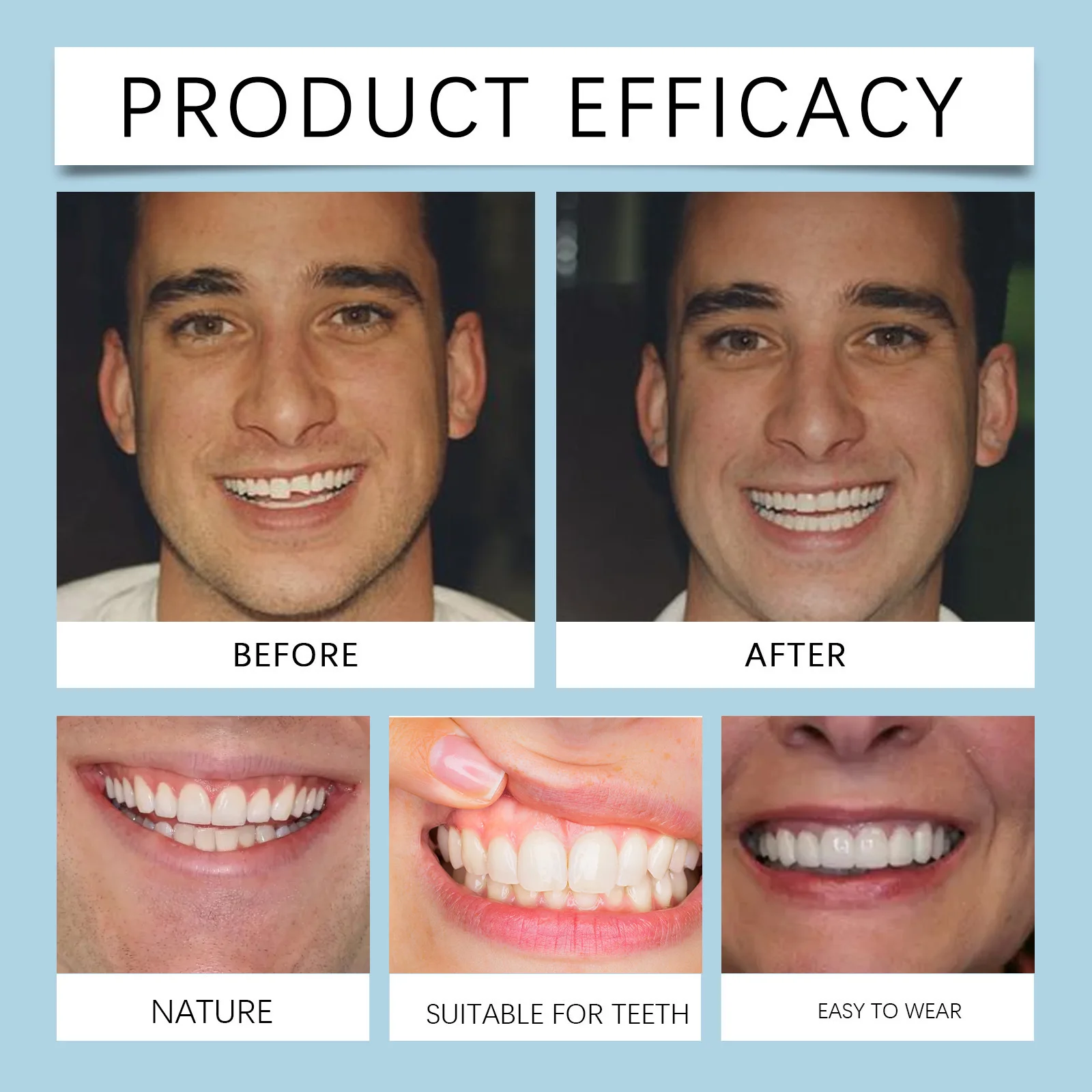 PIORPOY 1Pair Denture Silicone Kit Adjustable Snap-in Denture Set Teeth Braces Bracket Temporary Tooth Decoration Model Dental