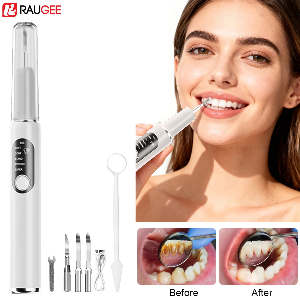 

Ультразвуковой зубной скалер, электрический очиститель зубов, средство для удаления камней, удаление зубного налета, отбеливание зубов, уход за полостью рта