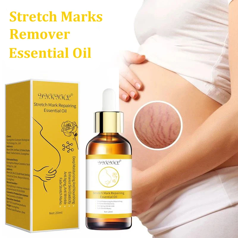 

Stretch Marks Remover Essential Oil Skin Care Treatment Cream For Stretch Mark Removal Maternity Slackline For Pregnant Oils