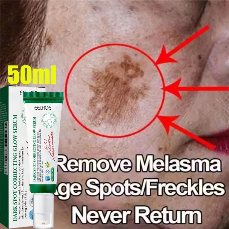 

Effective Whitening Freckles Face Cream Removal Melasma Dark Spots Fade Melanin Pigmentation Corrector Brighten Repair Skin Care