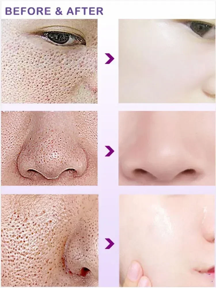 Pore Shrinking Serum Shrink Pores Cream Lactobionic Acid Shrink Pores Serum  Face Firming Face Pore Repair Shrink Pores