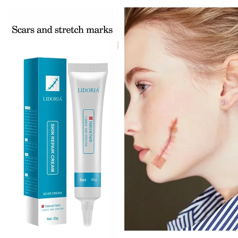 20g Skin Smoothing Repair Cream Rough Dryness Skin Scar Orange Peel Scar Repair Hydration Cream Removal Gel Fade Stretch Marks