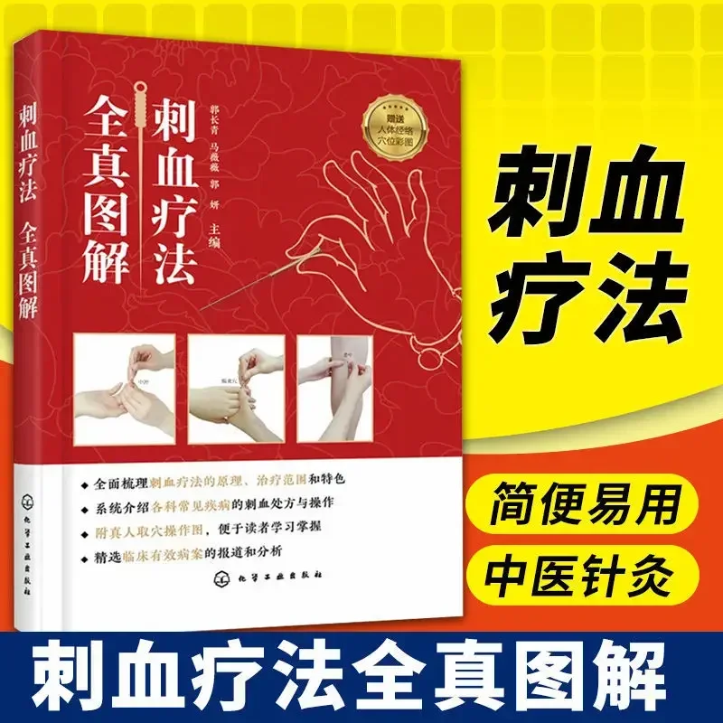 Complete Picture of Blood Pricking Therapy, Book of Blood Pricking Therapy, Complete Book of Blood Pricking Therapy In China