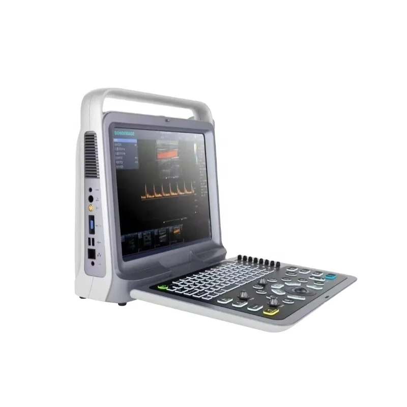 Portable Veterinary Ultrasound Scanner With Multi-Frequency Probes Large High-Definition LCD Screen 500GB Storage