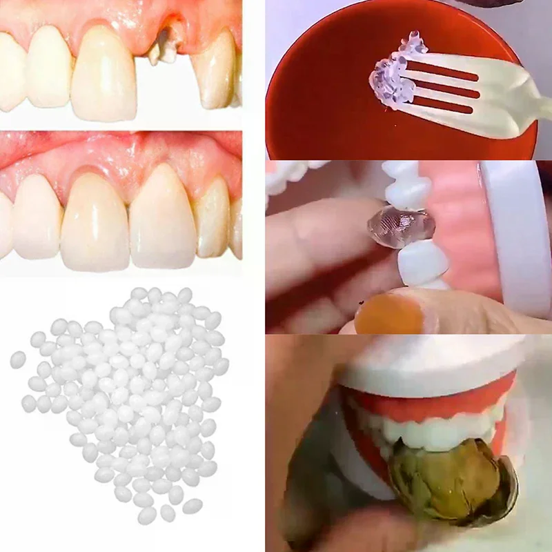 Temporary Tooth Repair Kit Teeth And Gaps False Teeth Solid Glue Denture Adhesive Teeth Whitening Tooth Beauty Tools 10g/15g/25g
