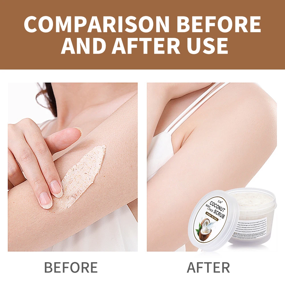 Thumbnail 2 - #11 Top 20 Scrubs Treatments Worth Buying In 2026