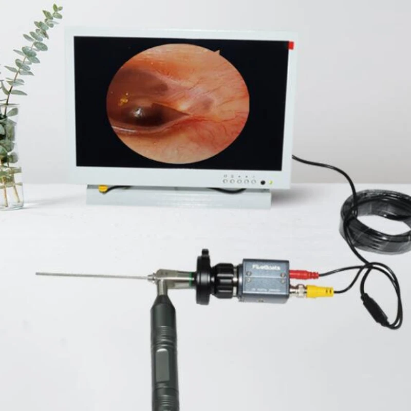 2.7mm cold light source otoscope visible otoscope nose high-definition endoscope mirror