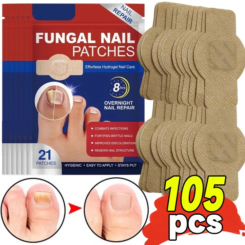 

105 шт. новый пластырь для ремонта ногтей, наклейка для коррекции вросших ногтей, серый пластырь для ухода за ногами, инструменты для ухода за ногами, водонепроницаемые пластыри с грибком