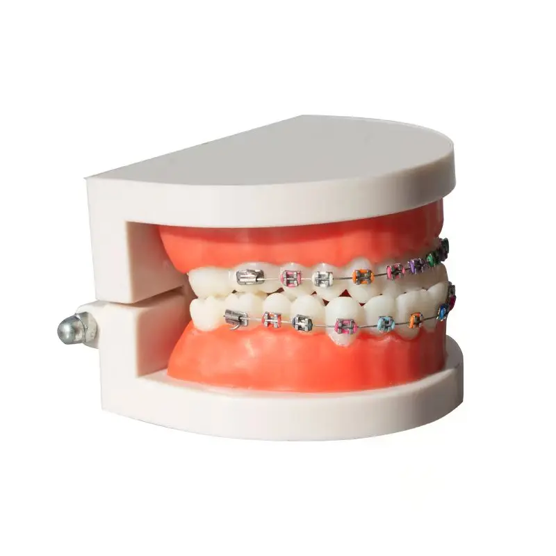 Oral Metal Bracket Model, Outpatient Doctor-Patient Communication Display, Dental Model, Bracket Model