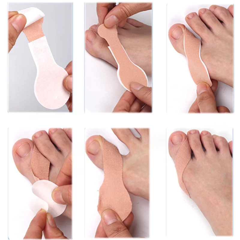 5 Stück Hallux Valgus ortho pä disches Pflaster Big Toe Separator Anti-Verschleiß-Fuß aufkleber Sports chutz gelenk fester Finger selbst klebend