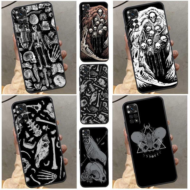 Skeleton  Bones Case For Xiaomi Redmi Note 10 Pro 8 9 12 11 Pro 8T 9S 10S 11S Redmi 9 10 10C 9A 9C Cover