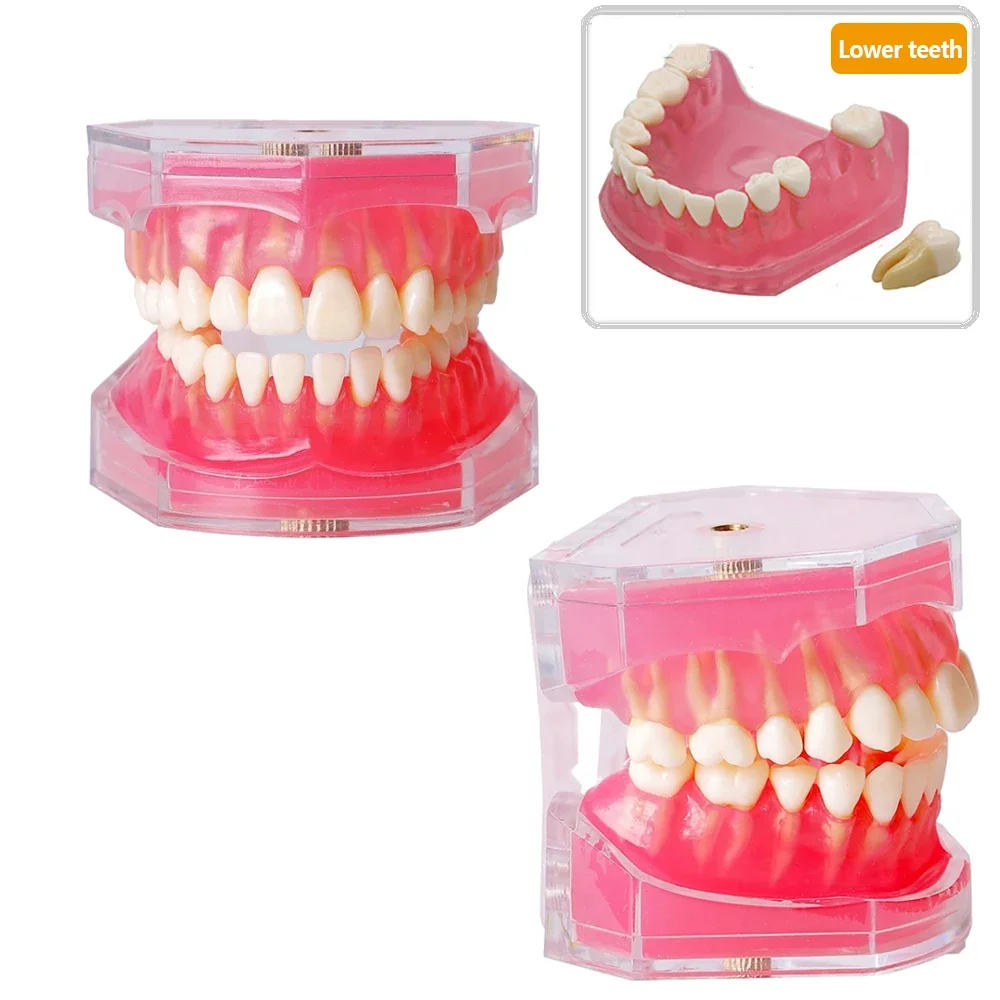 

28Teeth Dental Implant Training Model with Removable Teeth Standard Typodont Jaw Model Soft Gum Dentist Lab Demonstration Models