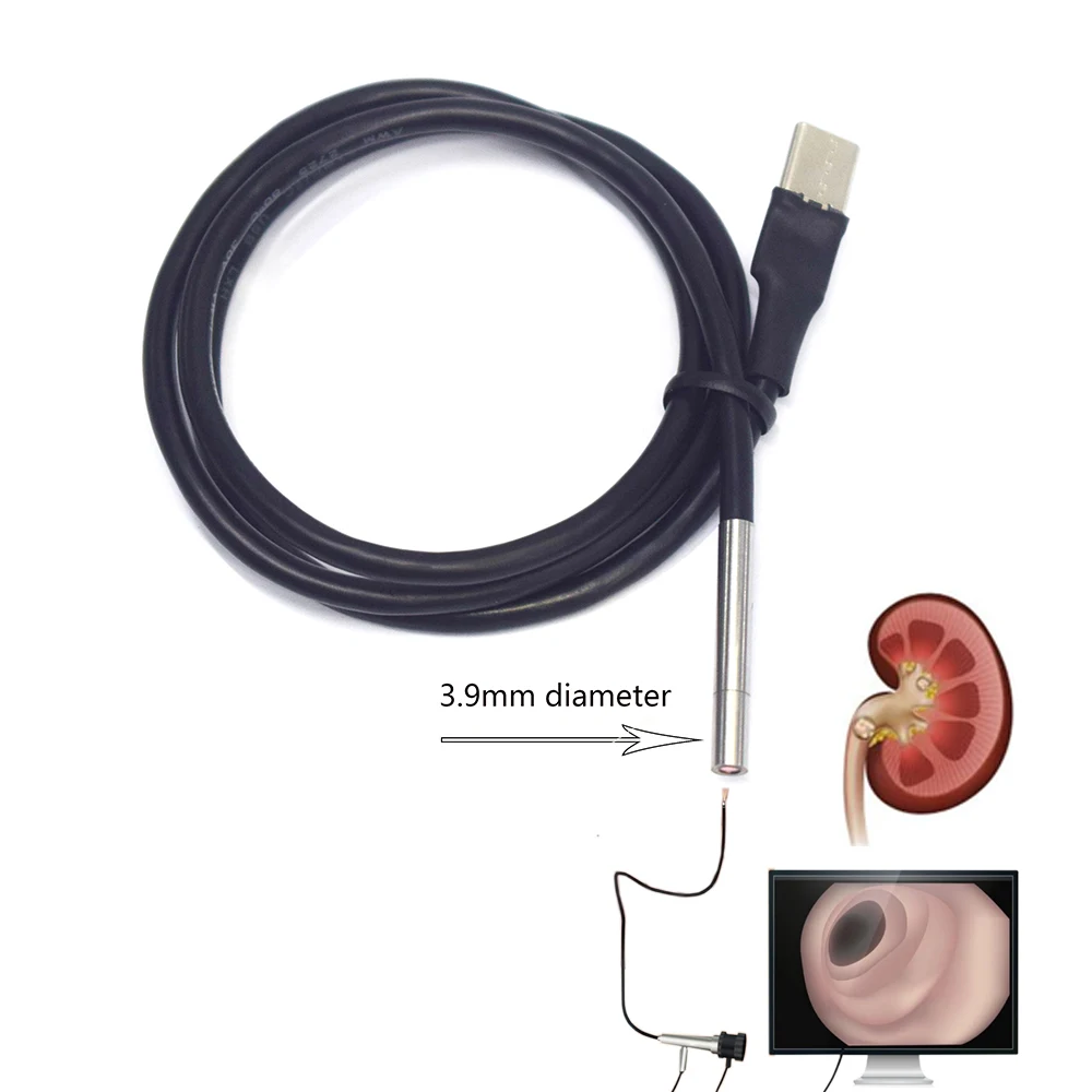 Urology single-use Flexible Ureteroscope Endoscope 9734