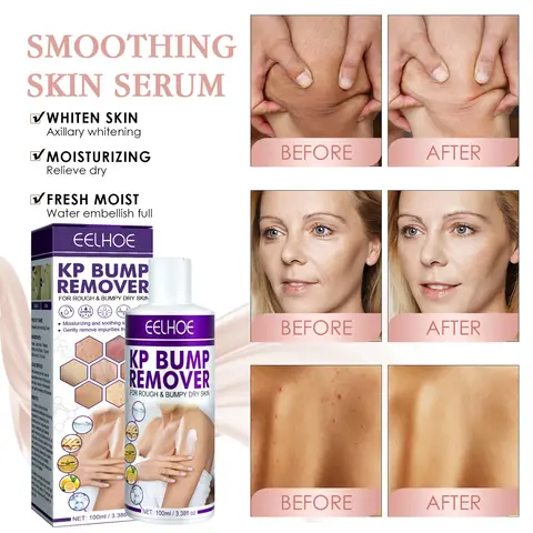 8 best sales kycklingskinn - №4